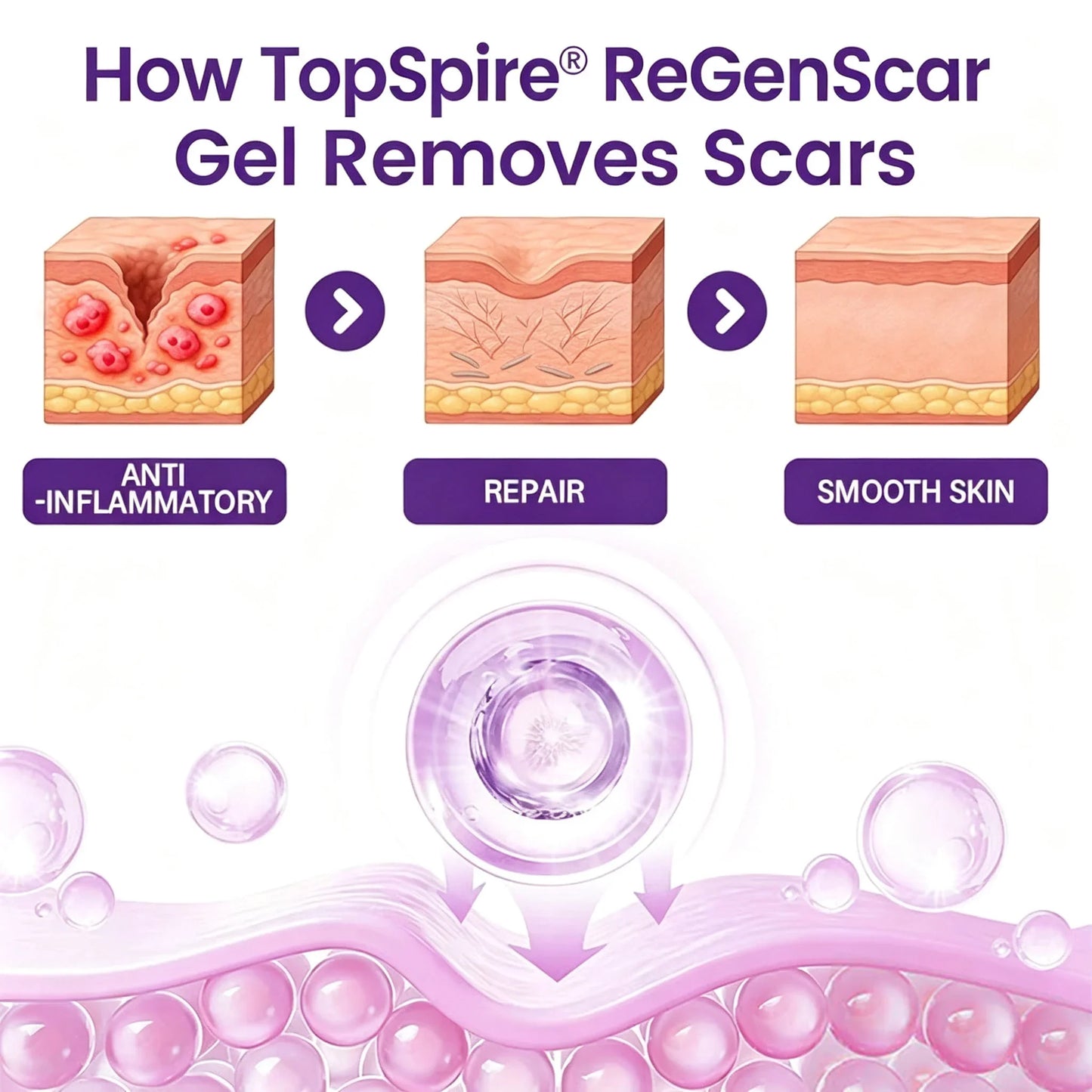 🔥TopSpire® ReGenScar Stem Cell Scar Gel
