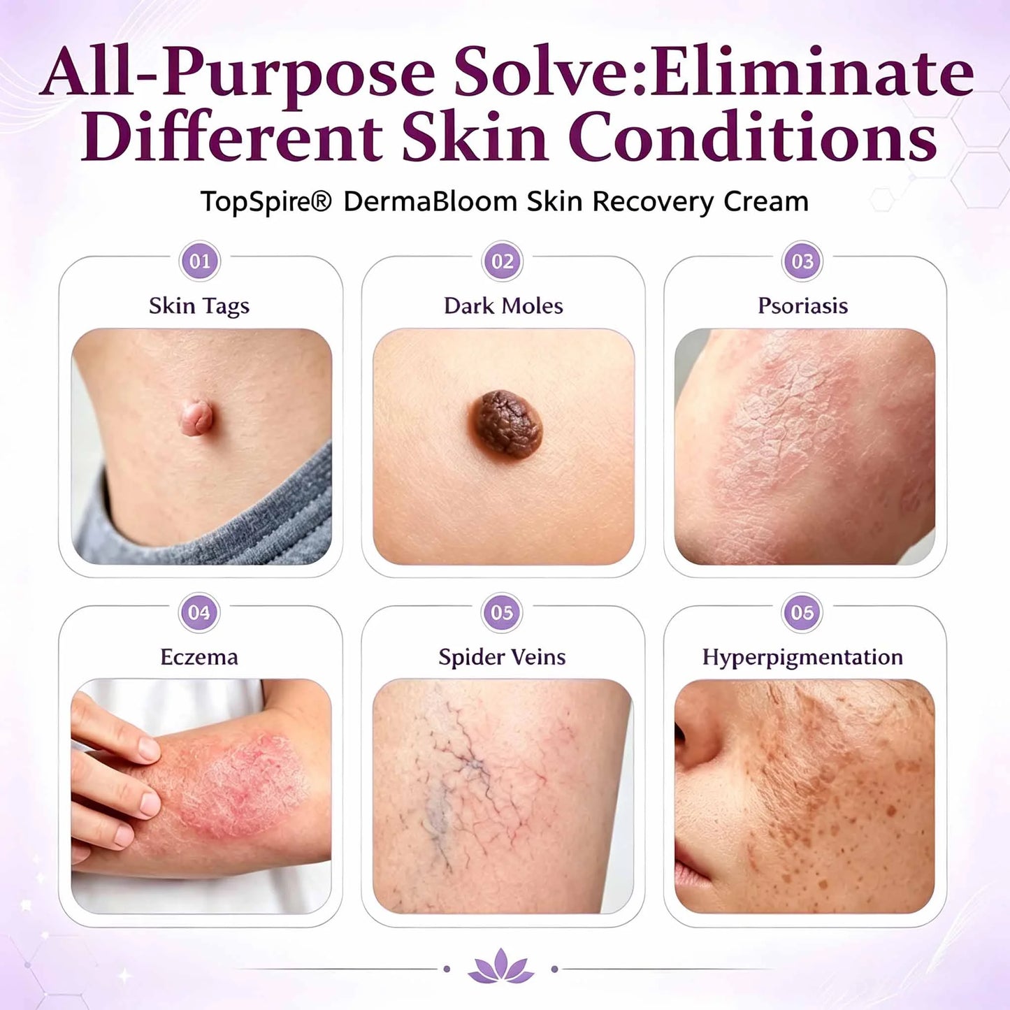 ✨TopSpire® DermaBloom Skin Recovery Cream