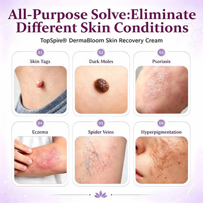 ✨TopSpire® DermaBloom Skin Recovery Cream