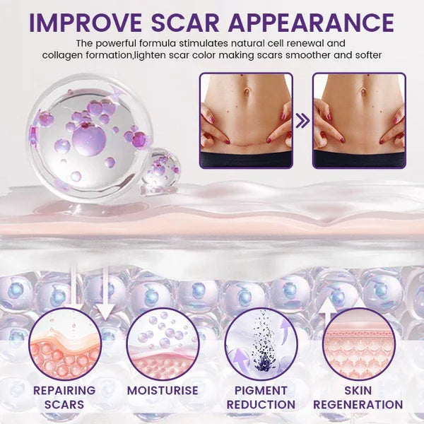 🔥TopSpire® ReGenScar Stem Cell Scar Gel