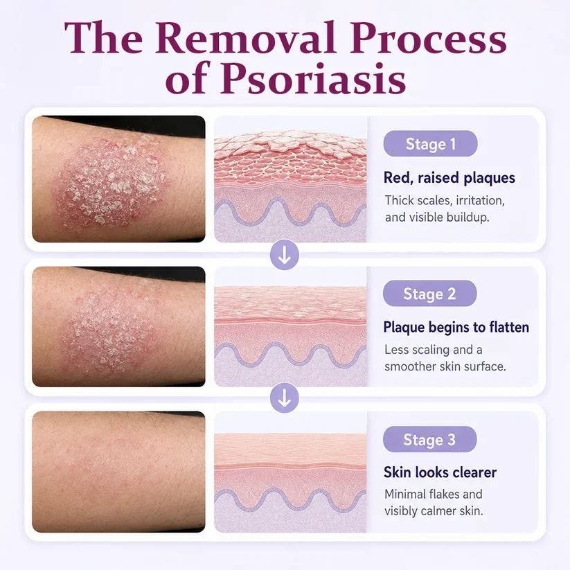 ✨TopSpire® DermaBloom Skin Recovery Cream