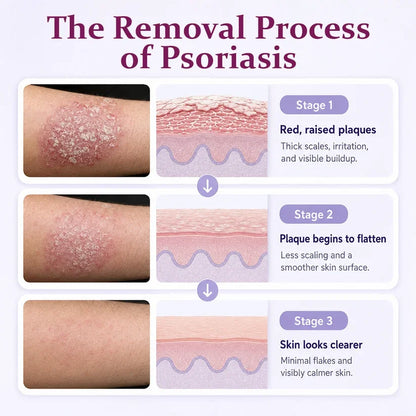 ✨TopSpire® DermaBloom Skin Recovery Cream