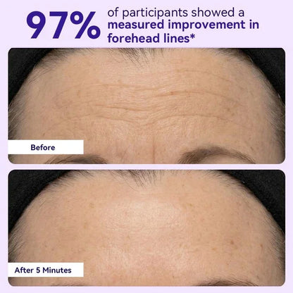 Instant Lift Eye Gel — Reduce the Look of Eye Bags in Minutes 🔥